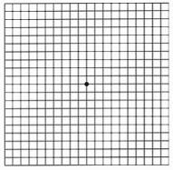 Amsler Grid Test